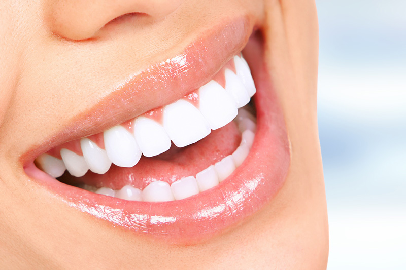 Cosmetic Dentistry in Holland